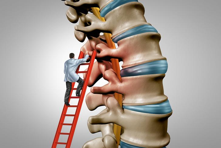spinal stenosis symptoms