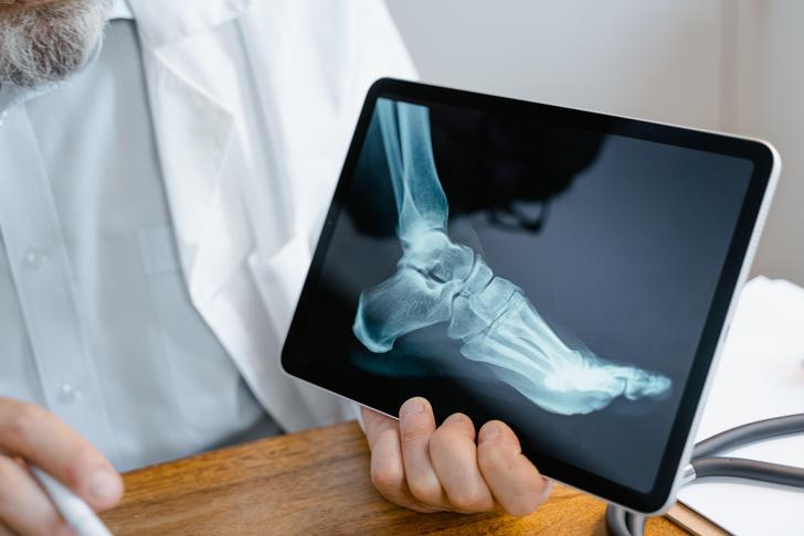 X-ray of a foot on a tablet