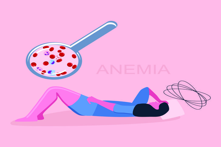 anemia dizziness
