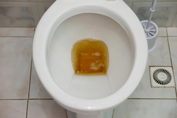 dark urine
