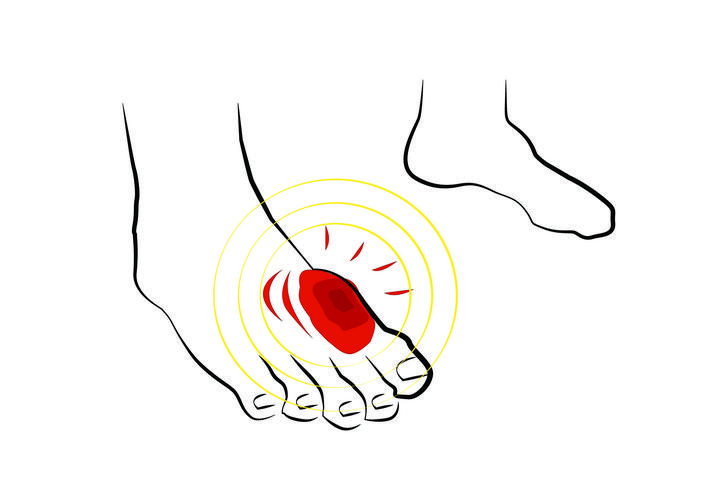 infections neuropathy