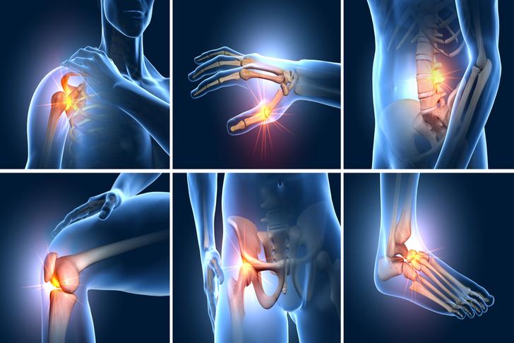 joint pain-osteoporosis