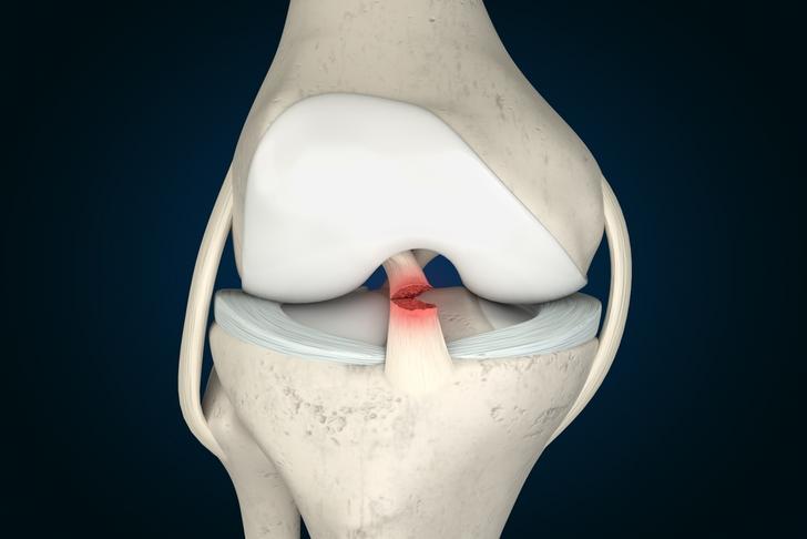 ligament injuries-knee