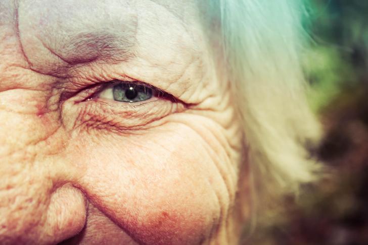 older woman aged skin