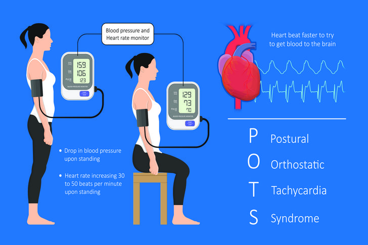 orthostatic hypotension-dizziness