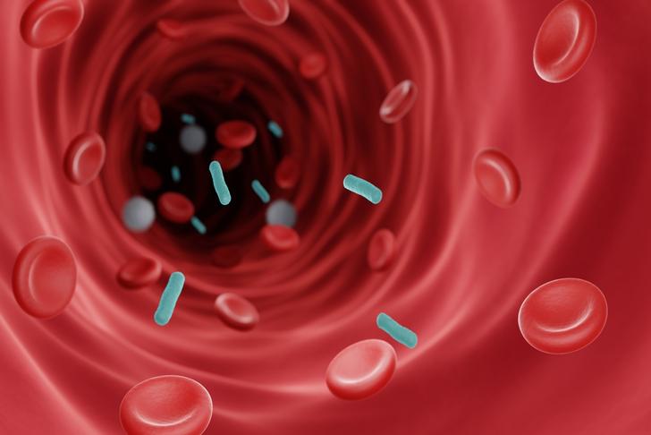 septicemia low-blood-pressure