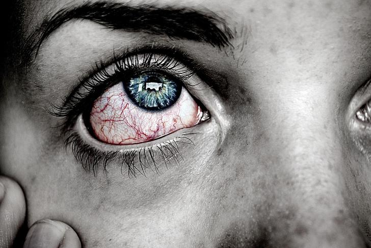 woman looking up with veins in her eye showing